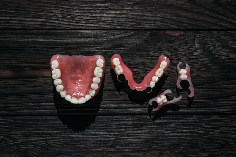 Protezy overdenture. Stabilność i wygoda